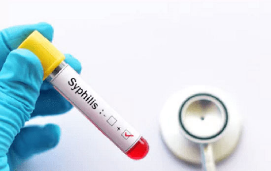 Bệnh giang mai có chữa được không