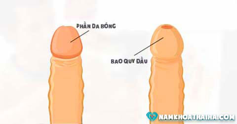 Các bệnh về bao quy đầu