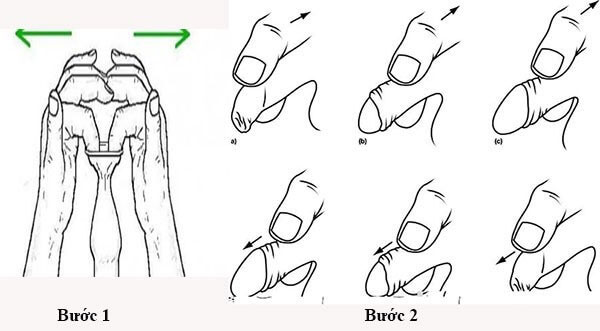cách tự lột bao quy đầu