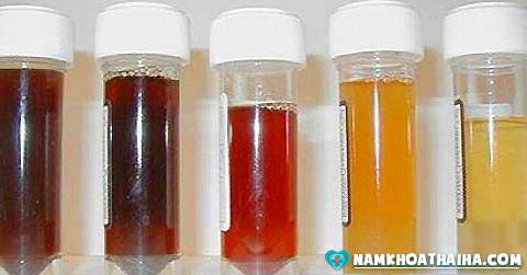 Màu nước tiểu - đi tiểu ra máu