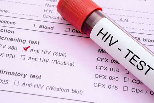 địa chỉ xét nghiệm HIV ở Hà Nội