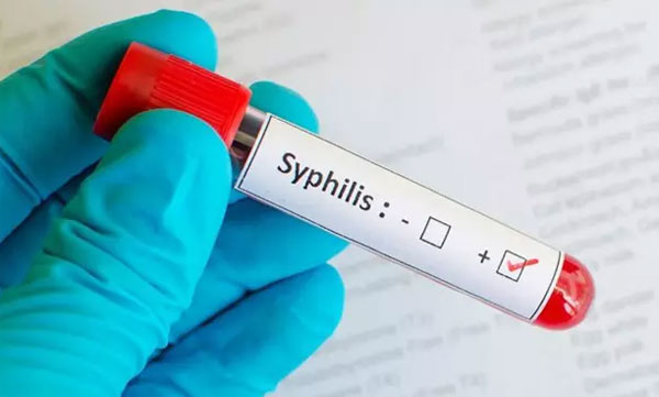 Khám, xét nghiệm bệnh giang mai ở đâu, chi phí bao nhiêu tiền