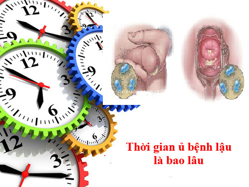 Thời gian ủ bệnh lậu sau bao lâu thì phát bệnh