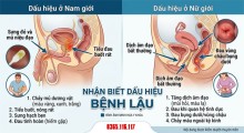 Dấu hiệu nhận biết bệnh lậu ở nam giới và phụ nữ