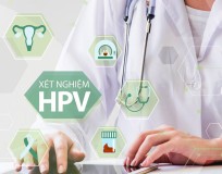 HPV là gì, xét nghiệm HPV ở đâu Hà Nội
